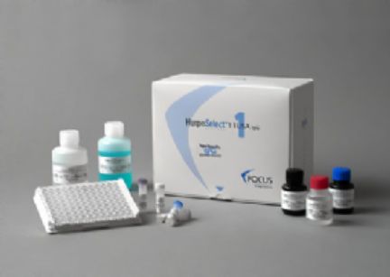 人抗核糖核蛋白抗体(RNP-Ab)ELISA试剂盒