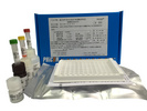 强直性脊柱炎B27检测试剂盒（磁酶联免疫法）