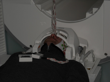 NeurOne脑电超扫描系统