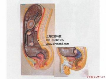 腹膜矢状切面模型