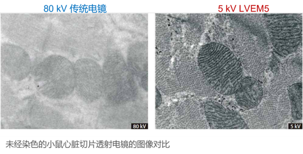 强大的生物成像新工具！5kV低电压设计、无需染色的低电压台式透射电子显微镜